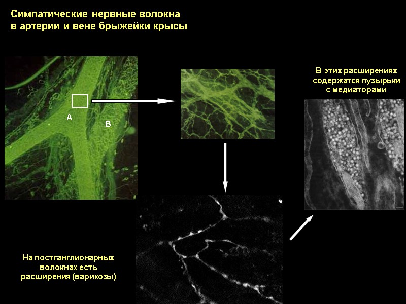 А В На постганглионарных волокнах есть расширения (варикозы) В этих расширениях содержатся пузырьки с